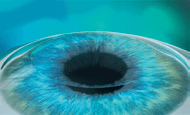 femto lasik step 4
